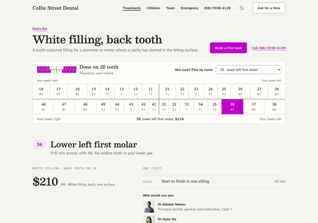Quadrant dental website template Next.js — White filling, back tooth page